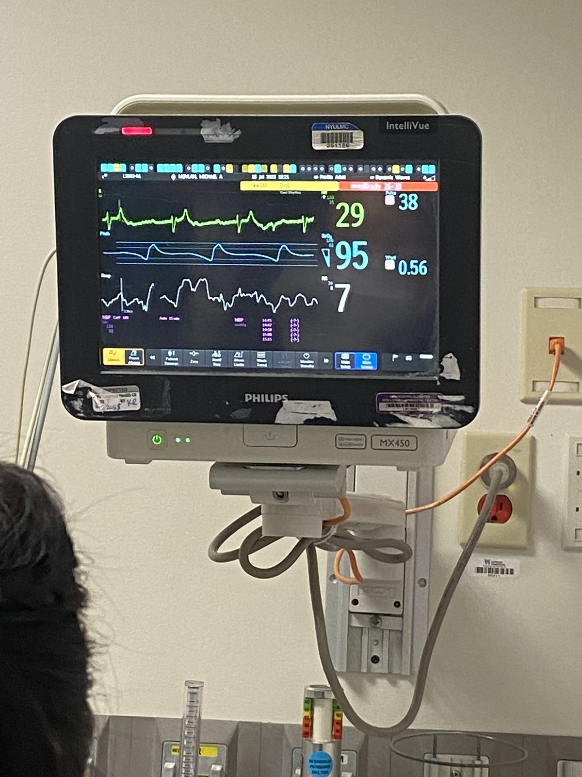Patient Monitor